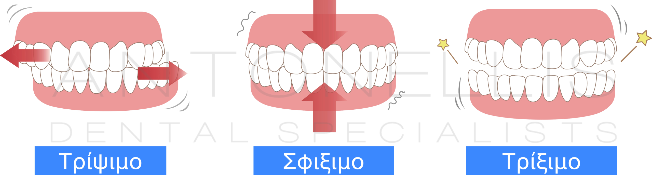 Причины скрежета зубами